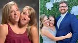 Are the Unfortunate Hensel Twins Still Alive?