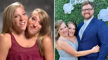 Are the Unfortunate Hensel Twins Still Alive?