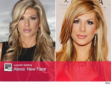Dashvib | Alexis Maloney Before and After Photos
