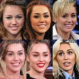 Did Miley Cyrus Get Plastic Surgery