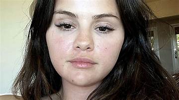 Dive into Selena Gomez's Natural Beauty: Uncovering Her Pre-Surgery Appearance