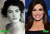 Exploring Kimberly Guilfoyle Pre Plastic Surgery: a Journey Through Transformation
