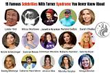 Famous Faces of Turner Syndrome: Inspiring Women with a Unique Condition