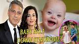 George Clooney's Son and Down Syndrome: a Heartfelt Journey