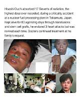 Hisashi Ouchi's Tragic Death: Lessons from Tokaimura Nuclear Accident