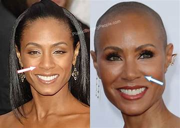 Jada Pinkett Smith's Nose Job: Before and After Photos