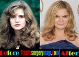 Jennifer Jason Leigh's Plastic Surgery: Uncovering the Hidden Truths