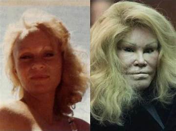 Jocelyn Wildenstein Young Photos