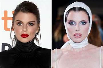 Julia Fox's Lip Fillers: Transformation, Controversy, and Beyond