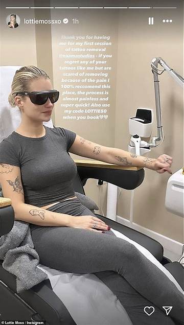 Lil Soup Shares Her Face Tattoo Removal Process on Tiktok