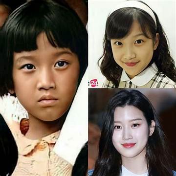 Moon Ga Young's Plastic Surgery: Before and After Analysis