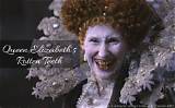 Queen Elizabeth I's Troublesome Teeth