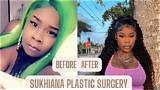 Sukihana Plastic Surgery: Everything You Need to Know