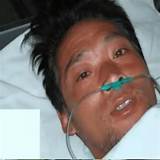 Surviving a Critical Tragedy: Hisashi Ouchi's Harrowing Story