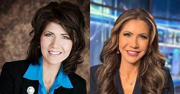The Startling Transformation: Before and After Kristi Noem's Plastic Surgery