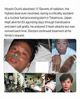 The Tragic Demise of Hisashi Ouchi: How Did He Perish?