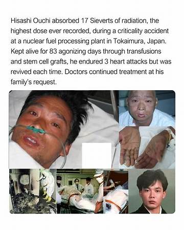 The Tragic Demise of Hisashi Ouchi: How Did He Perish?