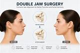 The Ugly Truth: Double Jaw Surgery Gone Horribly Wrong