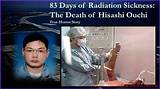 The Unbelievable Tale of Hisashi Ouchi: a Story of Survival and Endurance