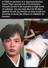 The Unseen Tragedy: Hisashi Ouchi's Severe Facial Deformities
