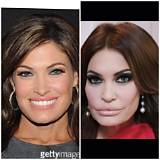 Unbelievable Transformation: Kimberly Guilfoyle's Plastic Surgery Journey