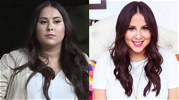 Unveiling Claudia Oshry's Chin Surgery Journey: Before and After