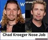 Unveiling the Truth: Did Chad Kroeger Have Children?